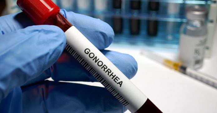 Nuevas píldoras revolucionarían tratamiento contra la gonorrea