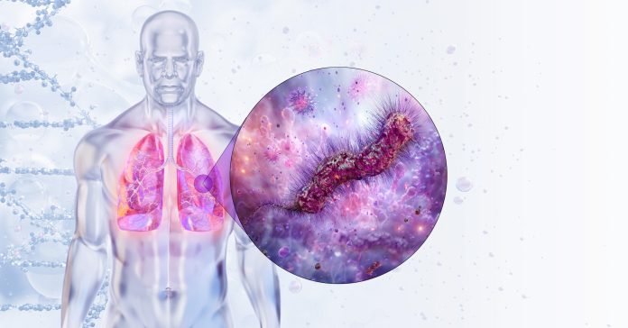 En Harlem, Nueva York, el ambiente ha cambiado en los últimos días. Lo que comenzó como una investigación de rutina por algunos casos de neumonía, se convirtió en un brote serio de legionelosis, una infección respiratoria grave que ya ha dejado al menos dos personas fallecidas y 58 casos confirmados.