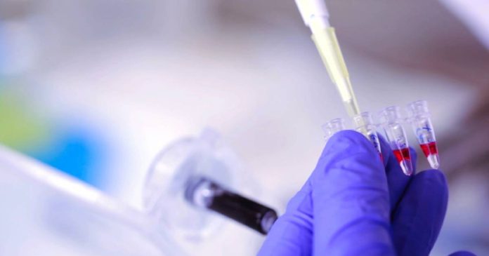 Antígenos claves en la detección de colitis