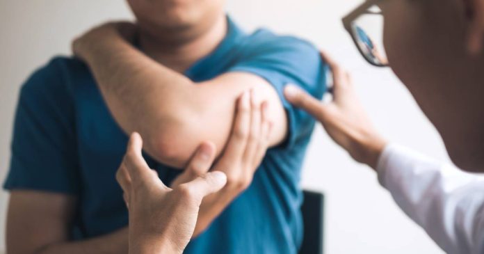 Muchas personas con psoriasis desarrollan artritis psoriásica años después de manifestarse los síntomas de la piel.
