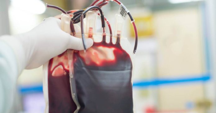 La hemodilución normovolémica aguda (HNA) consiste en una técnica de medicina transfusional en la que se extrae sangre de un paciente.