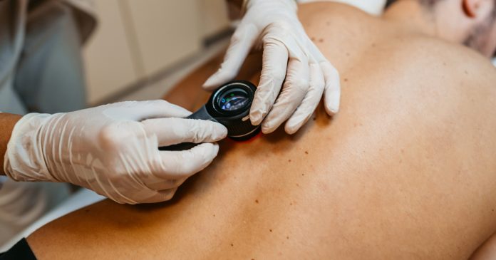 ¿Qué tratamientos hay para la psoriasis hoy día?