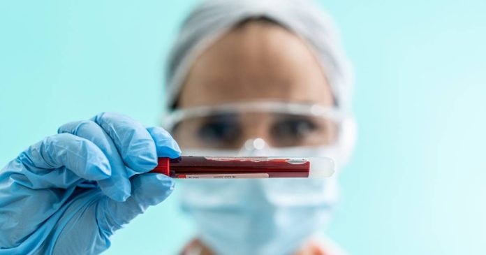 Según el Registro Central de Cáncer de Puerto Rico, entre 2015 y 2022 se diagnosticaron 755 casos de MDS en la isla