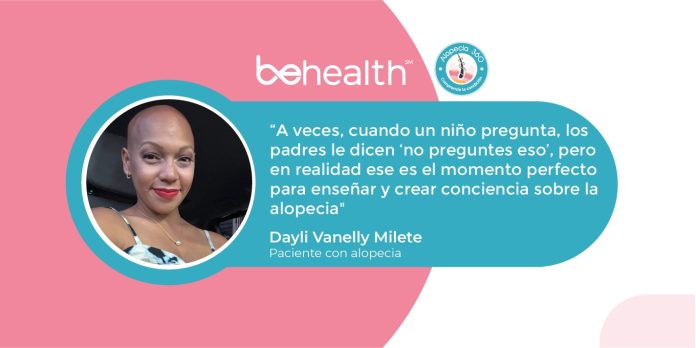 Dayli Milete comparte su proceso conviviendo con alopecia