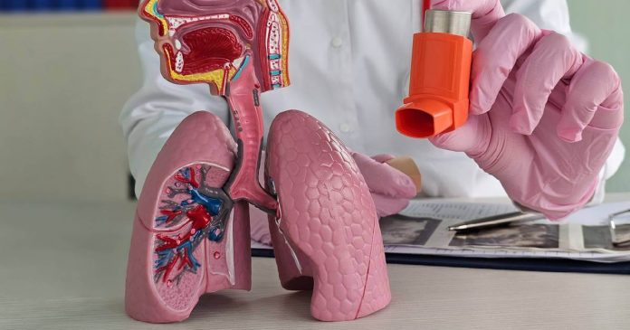 La enfermedad pulmonar obstructiva crónica, es una condición pulmonar común que reduce el flujo de aire y causa problemas respiratorios.