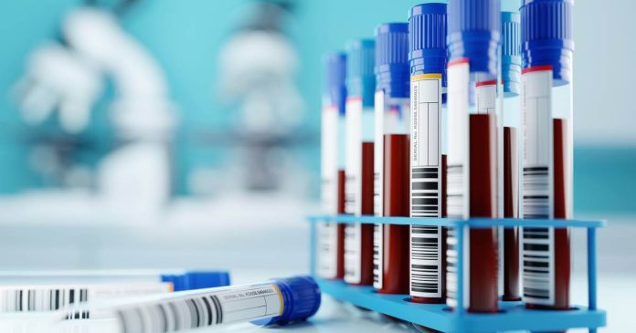 Científicos de Alemania han descubierto un anticuerpo eficaz contra el VIH, se evidenció que es capaz de prevenir infecciones y neutralizar al virus.