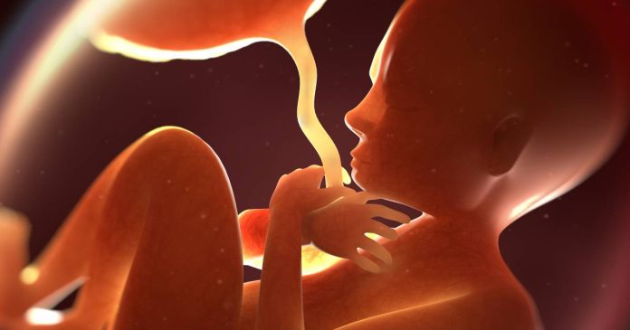 Aborto