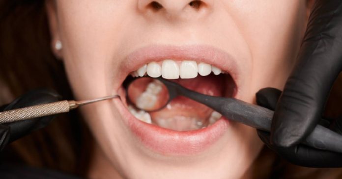 Salud dental y la relación con enfermedades cardiovasculares