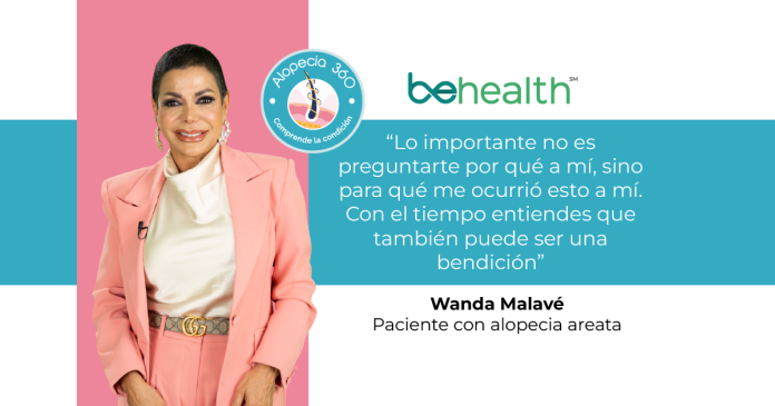 Wanda Malavé: cuando la alopecia se convierte en un camino de aceptación y amor propio