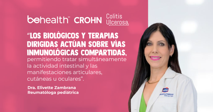 La Enfermedad Inflamatoria Intestinal (EII) no solo compromete el intestino. En muchos casos, el dolor se traslada a las articulaciones.