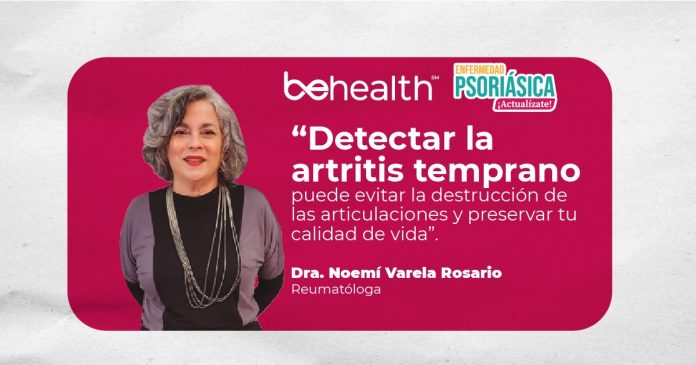 Artritis: cómo reconocer sus señales a tiempo y evitar daños irreversibles en las articulaciones