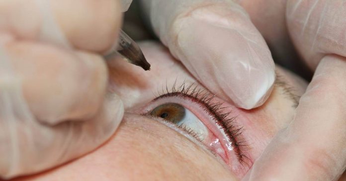 Nuevos estudios advierten el riesgo de la salud ocular relacionado con los tatuajes. Las consecuencias pueden ser irreversibles.