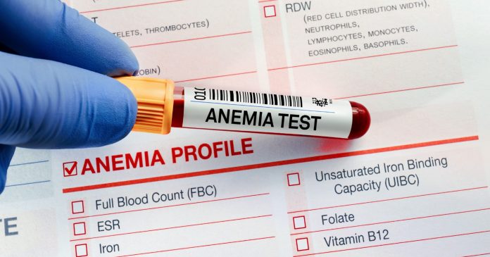 Anemia de Fanconi: la enfermedad genética que compromete la sangre y eleva el riesgo de cáncer