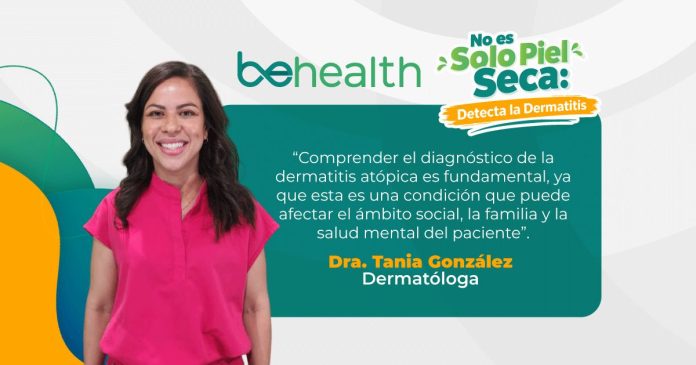 La Dra. Tania González, conversó sobre los aspectos claves que se deben tener en cuenta cuando un paciente padece de dermatitis atópica.