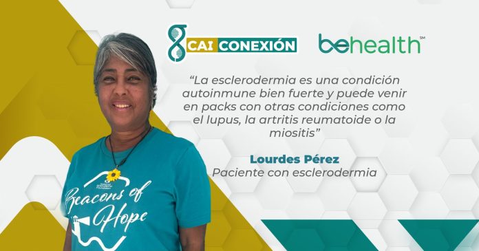 Esclerodermia: la historia de Lourdes Pérez y cómo aprendió a vivir