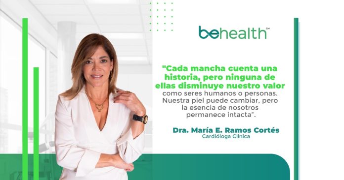 El vitíligo es una condición dermatológica autoinmune que se caracteriza por áreas de despigmentación progresiva en la piel.