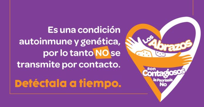 Los abrazos son contagiosos, la psoriasis no