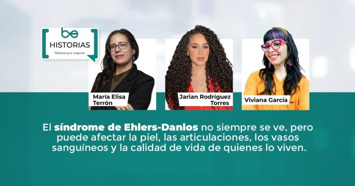 Síndrome de Ehlers-Danlos: pacientes relatan el largo camino hacia un diagnóstico y cómo enfrentan una enfermedad poco reconocida