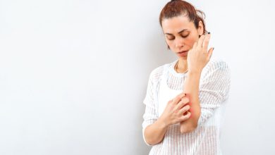 Las principales comorbilidades asociadas a la psoriasis son el síndrome metabólico, artritis psoriásica, enfermedades cardiovasculares, entre otras.