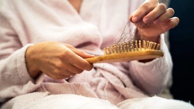 La alopecia areata principalmente afecta el cabello, aunque ocasionalmente puede generar alteraciones en las uñas.