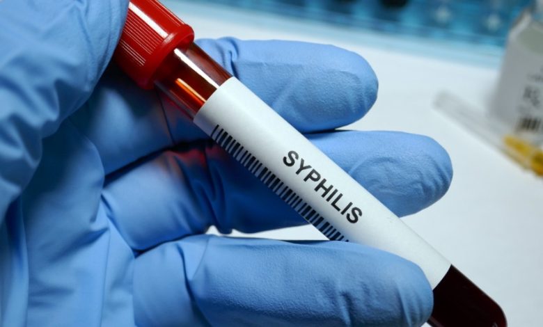 Conoce sobre la sifilis