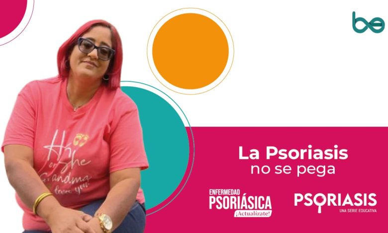 Yadira Torres: la psoriasis no se pega