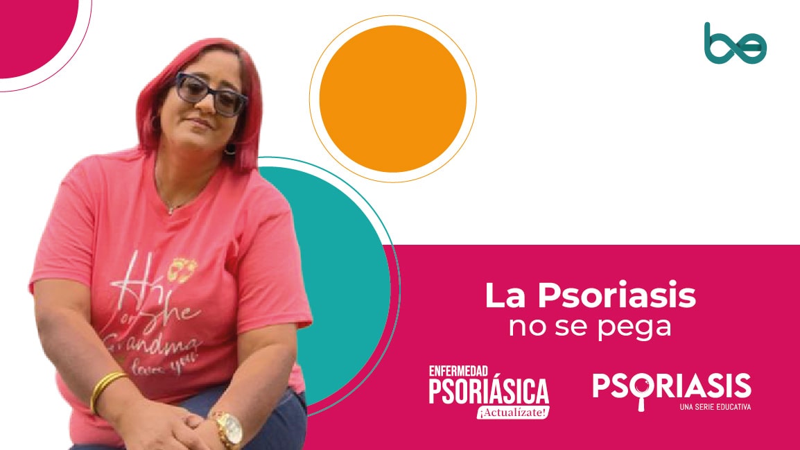 Yadira Torres: la psoriasis no se pega